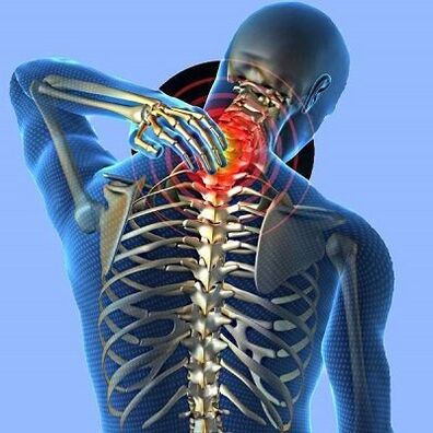 kaelavalu emakakaela osteokondroosiga