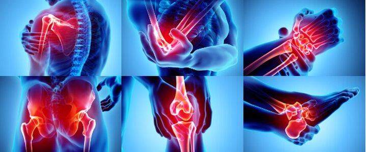 Põletikulised vuugid